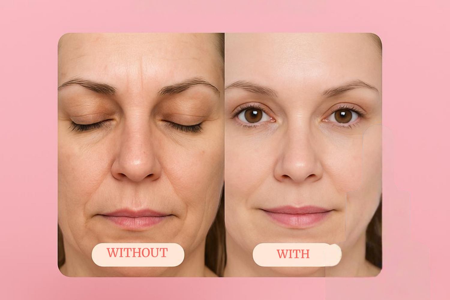 What is the Salmon Sperm Facial?