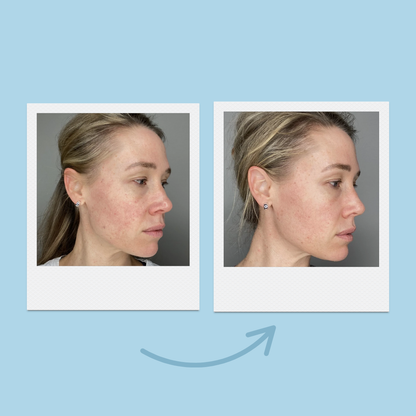 Liquid Microneedling + Copper Peptides Face Serum